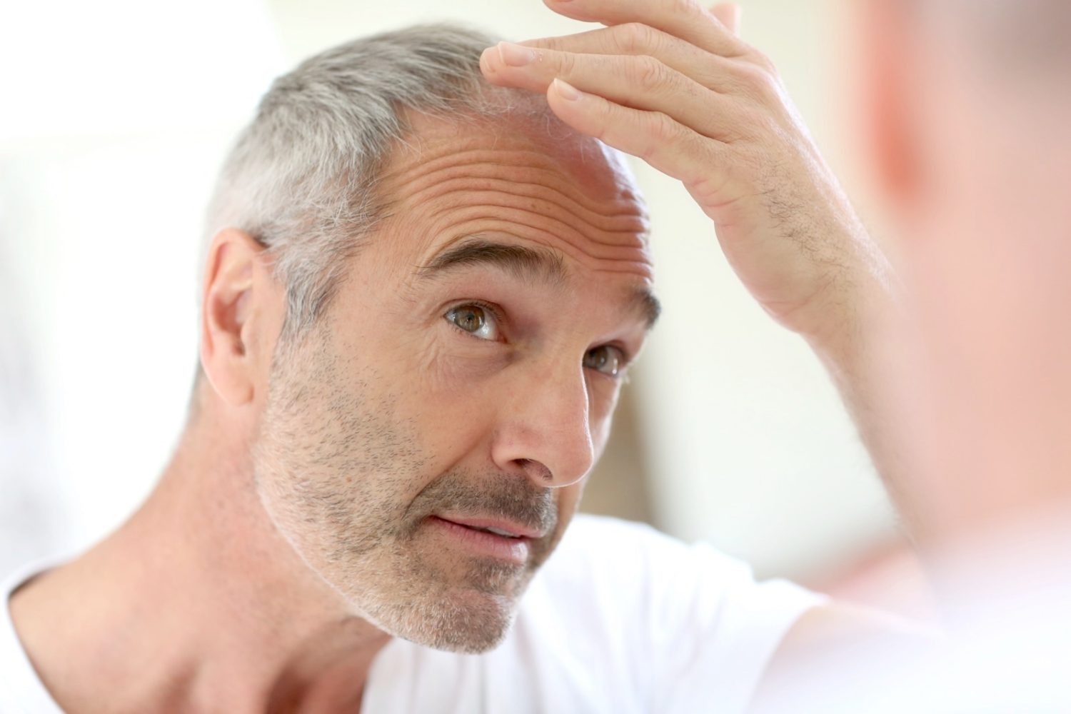 Groundbreaking sugar gel might be a miracle hair loss solution for men and women